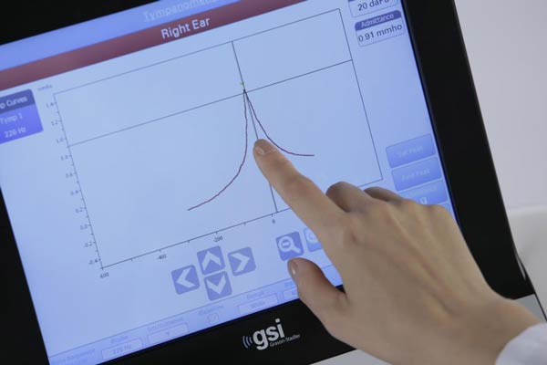 grason stadler tympanometer wideband example