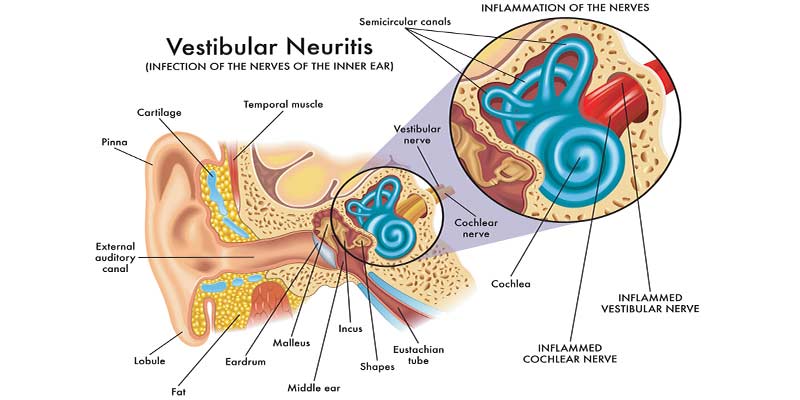 Vestibular Complex All You Need To Know About Vestibular