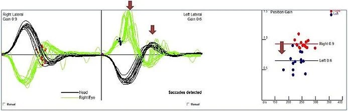 figure-5-vhit