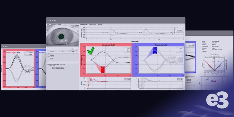 vhit comprehensive look at the goggles