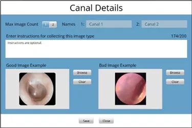 canal-details