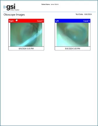 otoscope-images