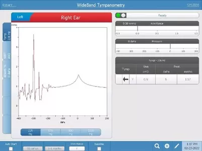 WideBand Tympanometry noise example