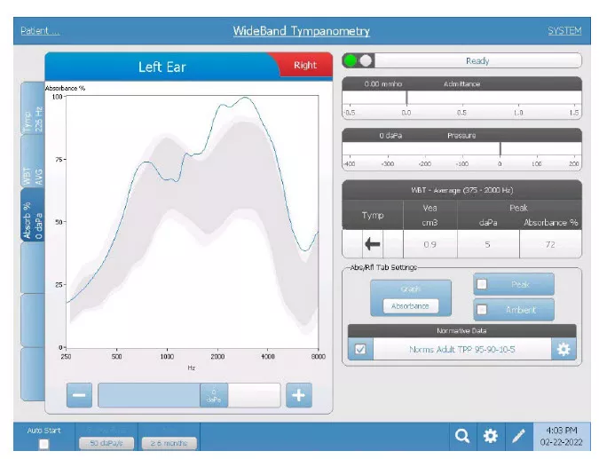 wideband-tympanometry-absorbance-graph
