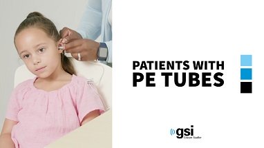 Allegro Patients with PE Tubes Video