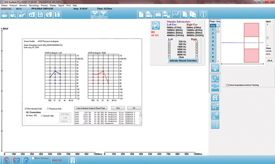 Assr Testing Software Clinical Evoked Potentials & OAE | Audera Pro | Grason-Stadler