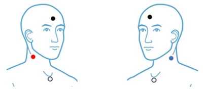 Vemp Lab Vestibular Evoked Myogenic Potentials (VEMP) | Testing Guides