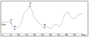 Late Latency Responses (LLR) | Testing Guides