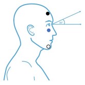 Vestibular Evoked Myogenic Potentials (VEMP) | Testing Guides