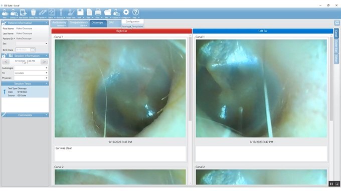 otoscope-image