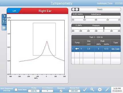 Tympstar Clinical Tympanometer | TympStar Pro | Grason-Stadler