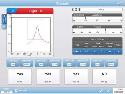 Clinical Tympanometer | TympStar Pro | Grason-Stadler