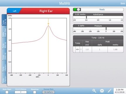 TympStar Pro Multi-Hz Screen