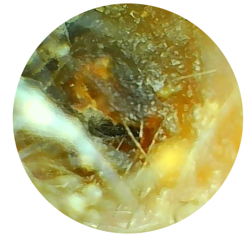 Using the Video Otoscope