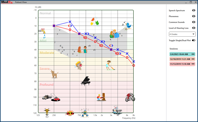 patient-view-audiogram-3