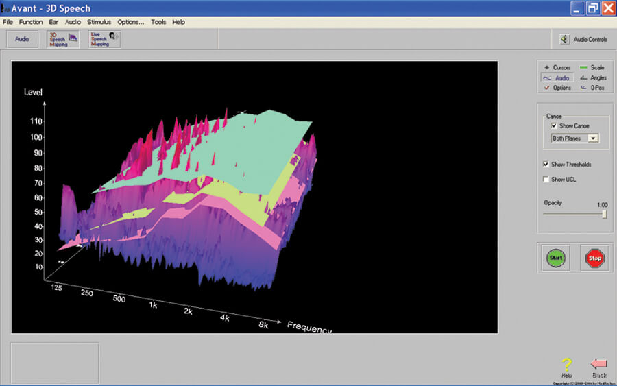 3-D Speech Mapping 