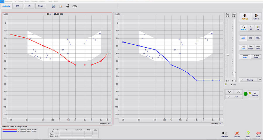 Dual Channel Audiometry screen shot