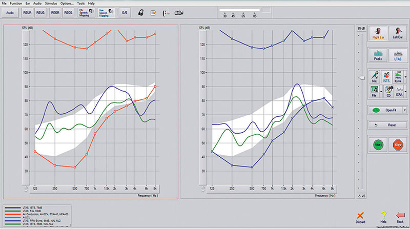Live Speech Mapping screen shot