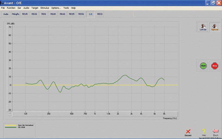 Occlusion Effect