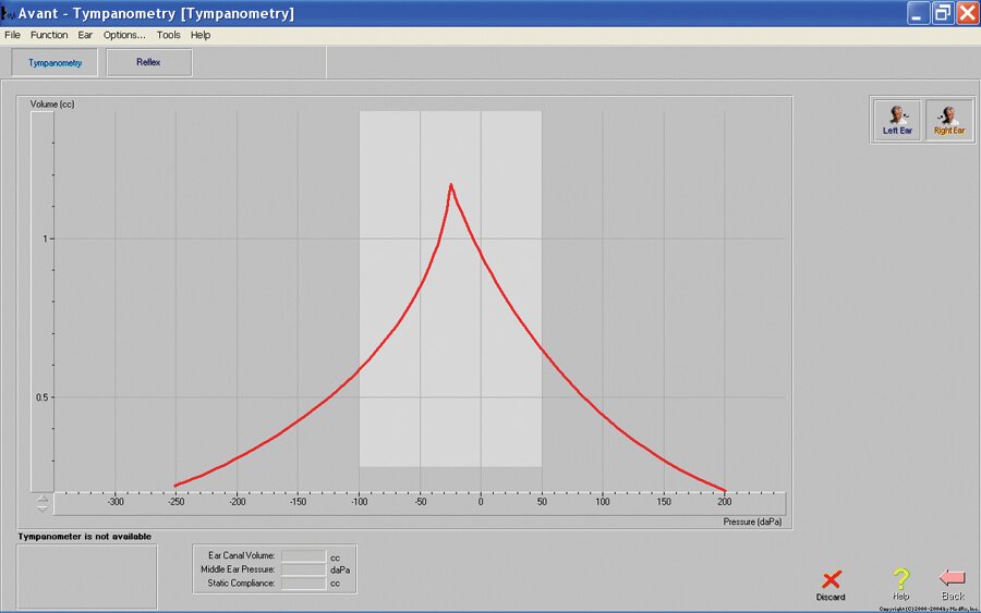 Tympanometry