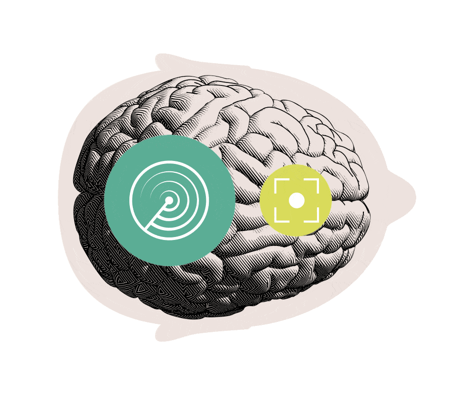 Oticon BrainHearing Technology Diagram